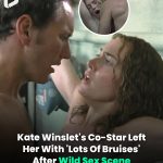 🎬 Kate Winslet Reveals She Was Left With ‘Lots of Bruises’ After Filming Wild Sex Scene 💥💋