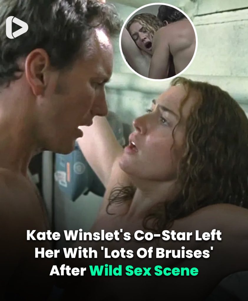 🎬 Kate Winslet Reveals She Was Left With ‘Lots of Bruises’ After Filming Wild Sex Scene 💥💋