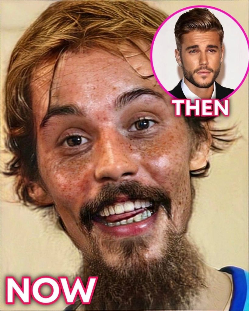 🥺Justin Bieber admits that he tested positive for…See More