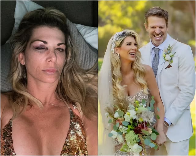 RHOC’s Alexis Bellino shocked fans when she officially released a camera clip of her husband John Janssen getting drunk and attacking her on their wedding night, leaving her with bruises around her eyes and accusing him of having an affair with a young girl.